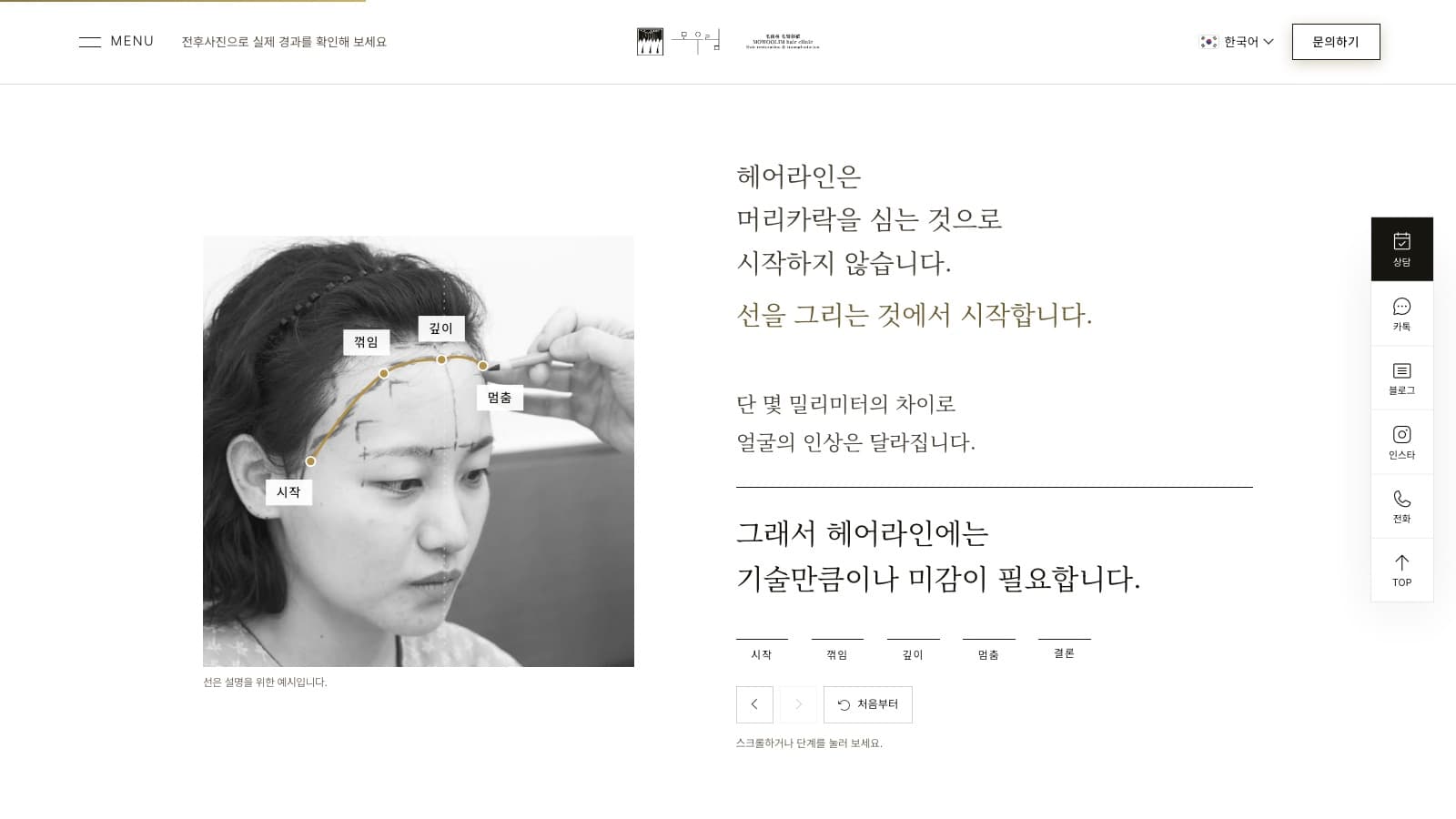 새 홈페이지에서 이마 위에 헤어라인의 시작·꺾임·깊이·멈춤 지점을 선으로 표시한 장면