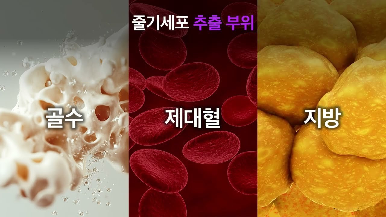 골수, 제대혈, 지방을 나란히 보여주는 줄기세포 추출 부위 설명 그래픽